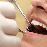 Picture of dental treatment